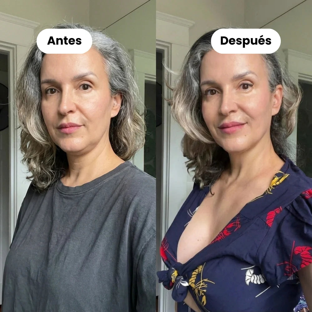 Banda facial reductora de papada (Compra 1 y llévate 1 GRATIS)