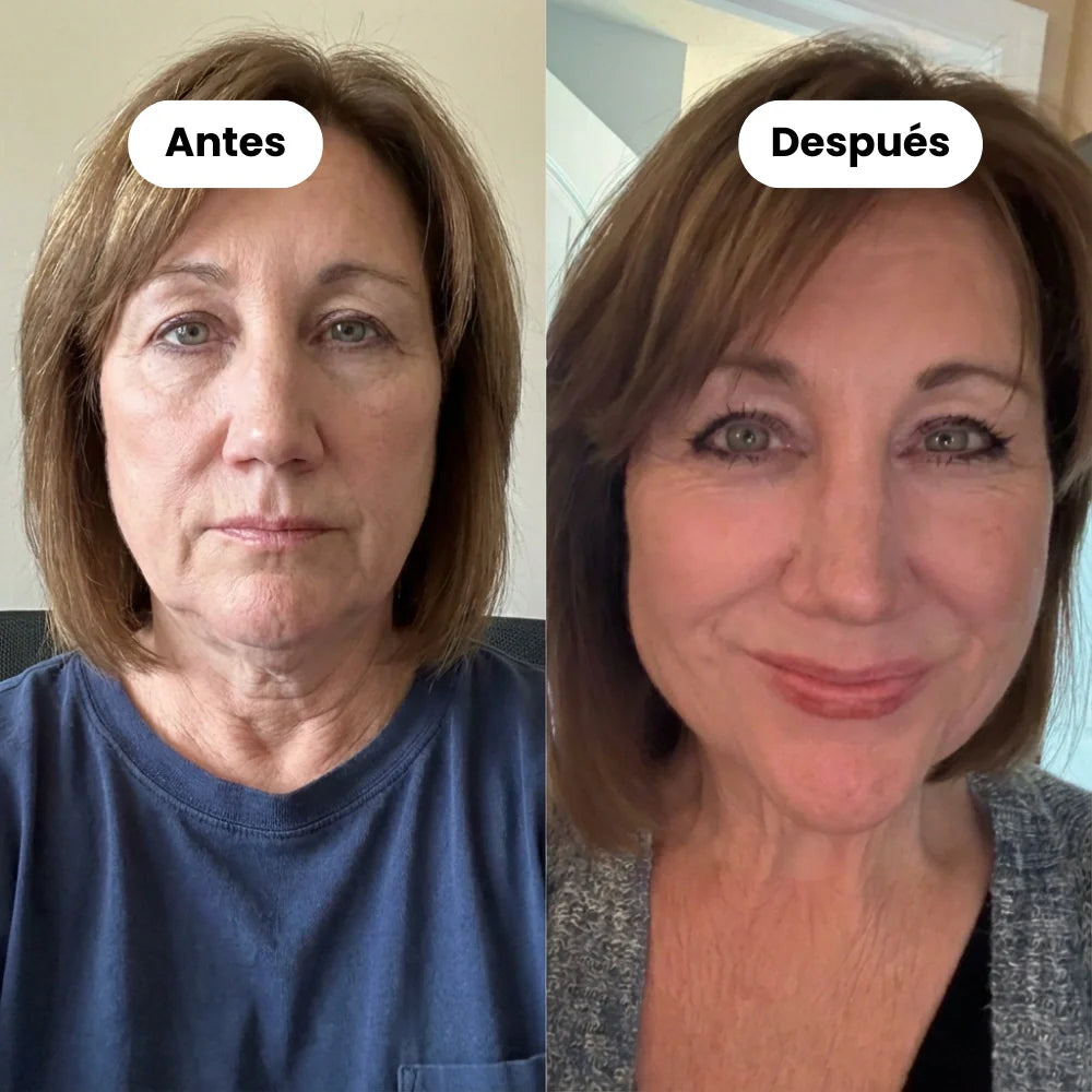 Banda facial reductora de papada (Compra 1 y llévate 1 GRATIS)
