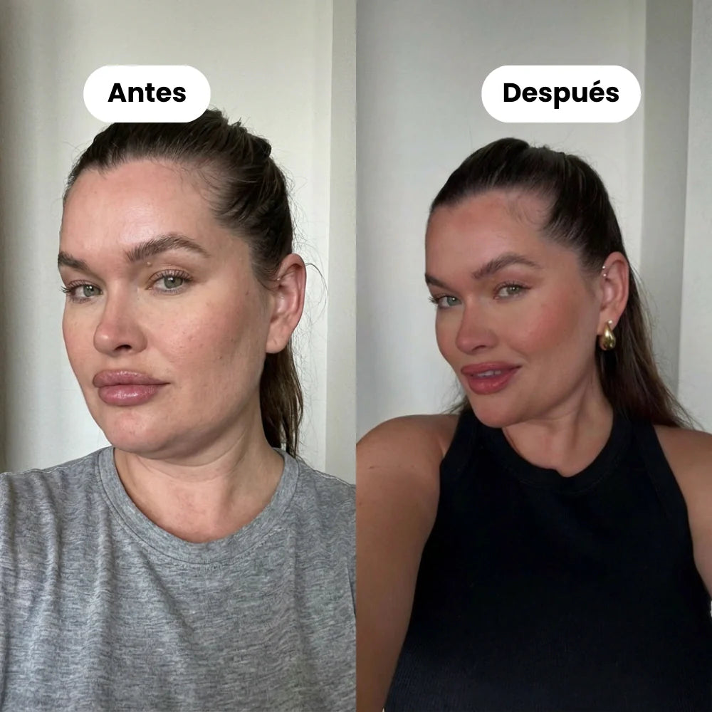 Banda facial reductora de papada (Compra 1 y llévate 1 GRATIS)